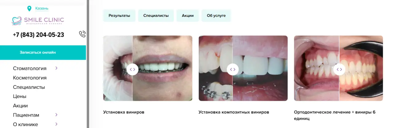 Кейсы на сайте стоматологической клиники
